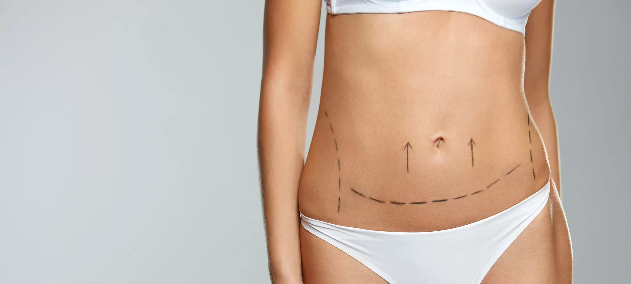 FAQs About Liposuction Surgery in Dubai: Common Concerns Addressed