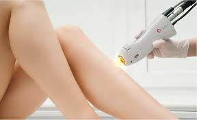 How effective is Candela laser hair removal